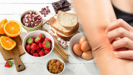 Kas ir pārtikas alerģija? Kam rodas pārtikas alerģijas un kādi ir tā simptomi?