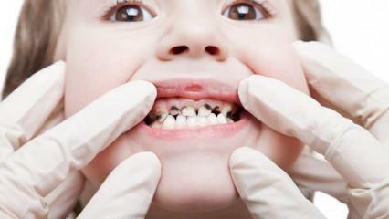 Veiciet sava bērna zobu kopšanu semestra laikā!