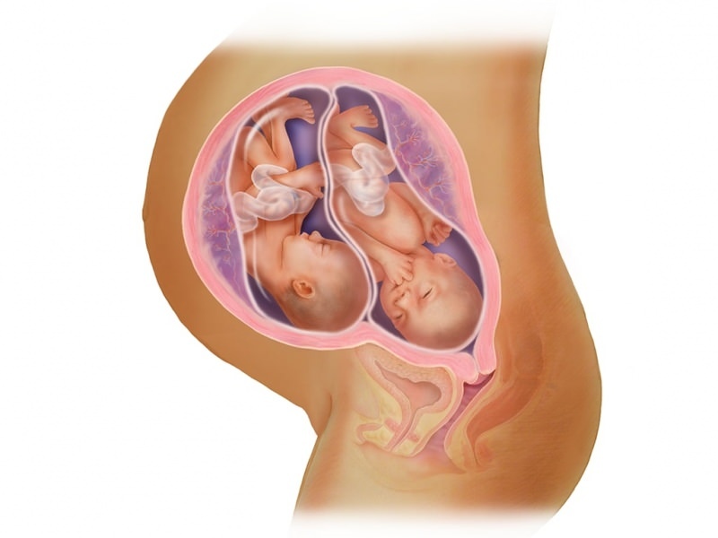 Dvīņu grūtniecība IVF! Kas ir embrija pārnešana?
