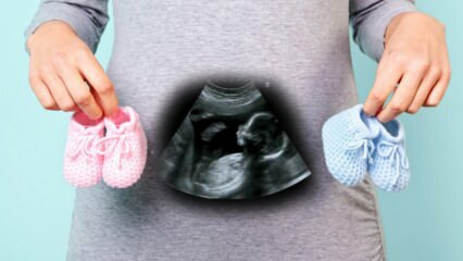 Vai bērna dzimums tiks noteikts grūtniecības pirmajā trimestrī?