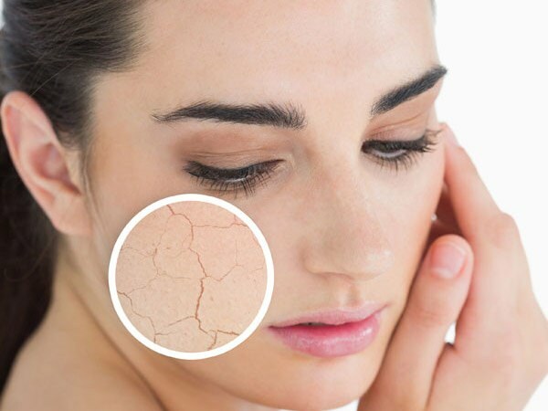 Kāpēc āda izžūst? Ko darīt uz sausas ādas? Visefektīvākie kopšanas ieteikumi sausai ādai