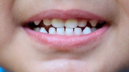 Kā iemācīt bērniem zobārstniecību?
