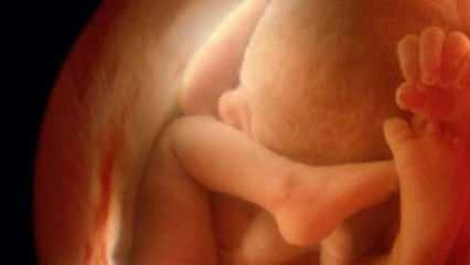 Nerāda mazuļa dzimumu ultraskaņā! Kā zēni un meitenes izskatās uz ultraskaņu?
