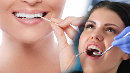 Kā saglabāt mutes un zobu veselību? Kas jāņem vērā, tīrot zobus?