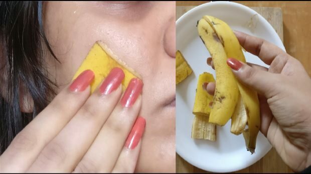 Vai banānu mizas dod labumu ādai? Kā banānu izmanto ādas kopšanā?