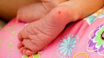 Kāpēc zīdaiņiem tiek ņemtas papēža asinis? Prasības asins papēžu pārbaudei zīdaiņiem