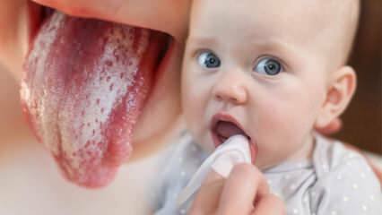 Strazdu simptomi un ārstēšana zīdaiņiem! Kā piena sēnīte ir zīdaiņiem?