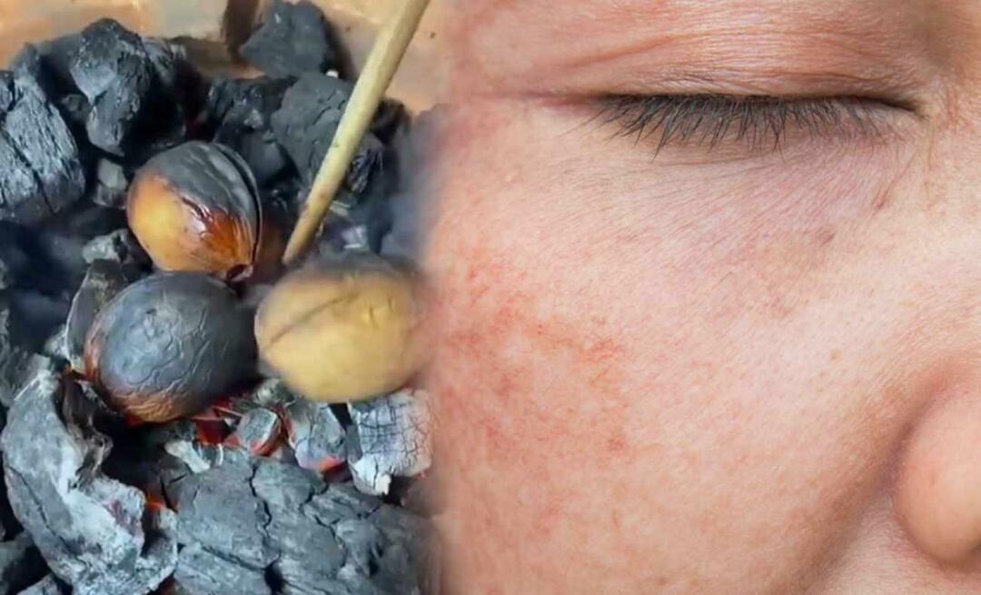 Valriekstu-olīveļļas maisījums, kas dzēš traipus un apdeguma pēdas uz sejas tikai ar vienu pildspalvu!