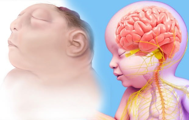 Vai Anencephaly mazulis dzīvo? Anencefalijas diagnoze
