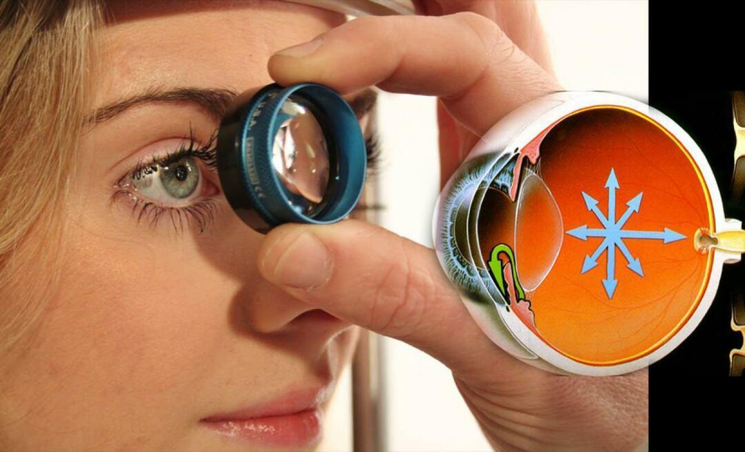 Kas ir glaukoma? Pievērsiet uzmanību šai slimībai, kas mānīgi progresē, neizraisot nekādus simptomus!