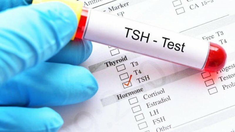 tsh tests ir hormonu tests