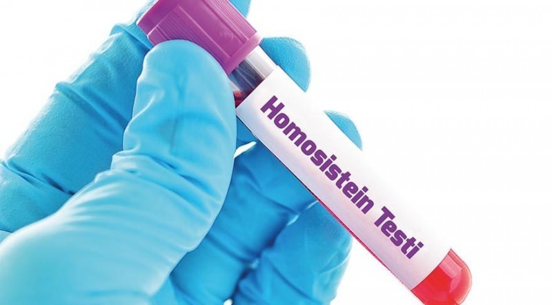 homocisteīna vielas līmeņa paaugstināšanās 