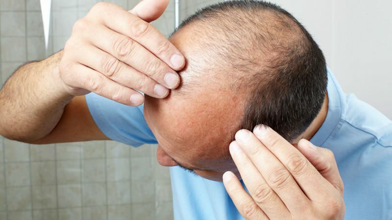 Vai matu transplantācija novērš ghusl?