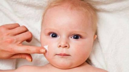 Ādas kopšanas padomi mazuļiem! Kādas ir mazuļu ādas problēmas?