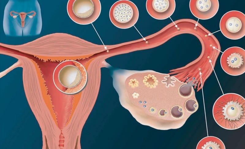 Kas ir implantācija? Kā atšķirt asiņošanu no menstruālās asiņošanas? Krāsa un konsistence ...