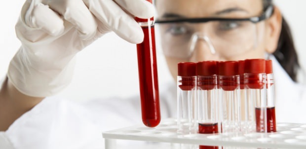 hemoglabīna līmeni pārbauda ar asins analīzi
