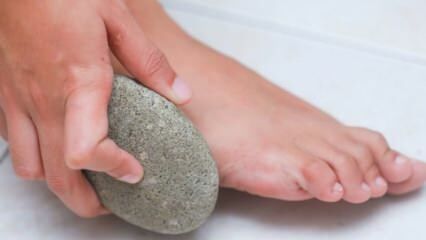 Kas ir papēža (pumeka) akmens? Kā izmantot papēža (pumeka) akmeni?