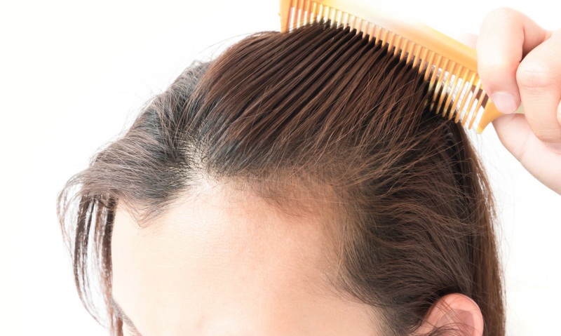 matu izkrišanas risinājumi pēc dzemdībām! Kas ir labs matu izkrišanai?