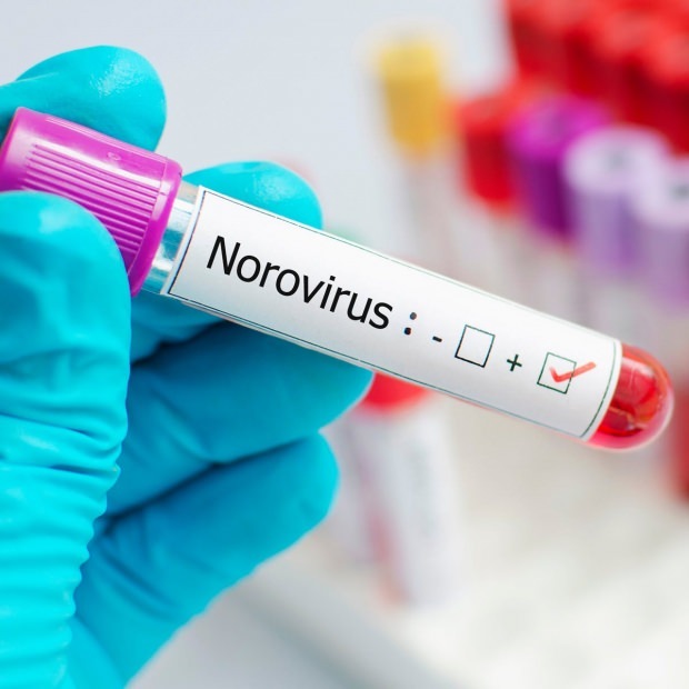 Kas ir norovīruss un kādas slimības tas izraisa? Nezināms par Norovīrusa infekciju ...