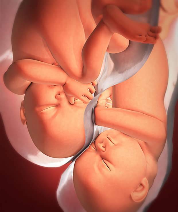 Kādi ir dvīņu grūtniecības simptomi?