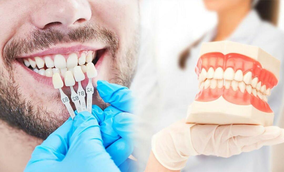 Kāpēc uz zobiem tiek uzklāti cirkonija kroņi? Cik izturīgs ir cirkonija pārklājums?