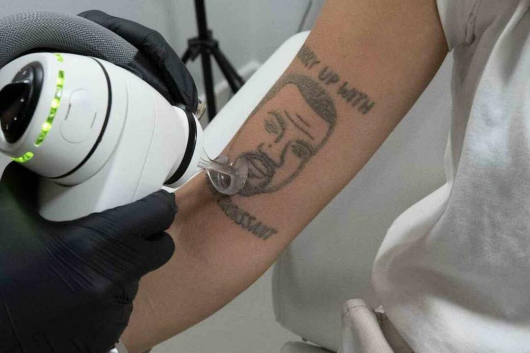 Kanje Vesta tetovējums Londonā tiks noņemts bez maksas 