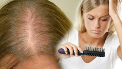Kāda ir visefektīvākā metode pret matu izkrišanu? Masku receptes, kas aptur matu izkrišanu