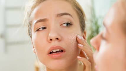 Kāpēc āda izžūst? Ko darīt uz sausas ādas? Visefektīvākie kopšanas ieteikumi sausai ādai