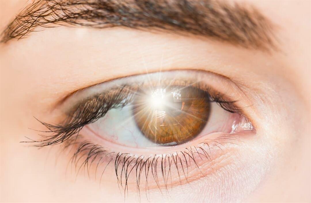 Kas izraisa gaismas uzliesmojumus acī un kā to ārstēt?