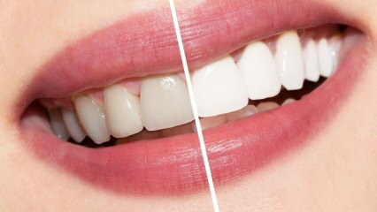 Kādi ir ieteikumi baltajiem zobiem? Zobu balināšana izārstē dabiski mājās ...