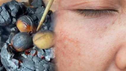 Valriekstu-olīveļļas maisījums, kas noņem traipus un apdegumu pēdas uz sejas!