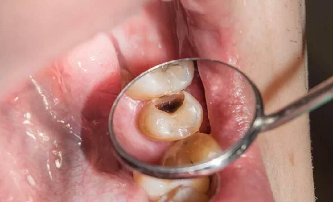 Kāpēc zobi pūt un ko darīt, lai to novērstu? 