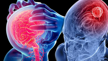 Kas ir smadzenīšu (mugurkaula) deģenerācija? Kādi ir smadzenīšu (muguras smadzeņu) simptomi?