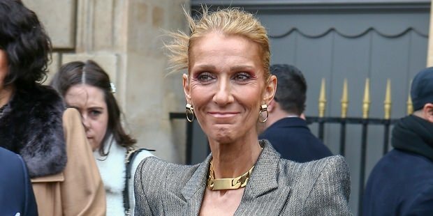 Celine Dion novājināta