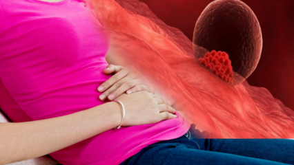 Kas ir implantācijas asiņošana grūtniecības laikā? Kā atšķirt implantācijas asiņošanu no menstruācijas asiņošanas